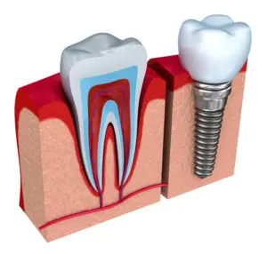 oral surgery Manchester