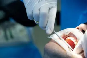 Learn what to expect at a consultation for Great River oral surgery in Dubuque